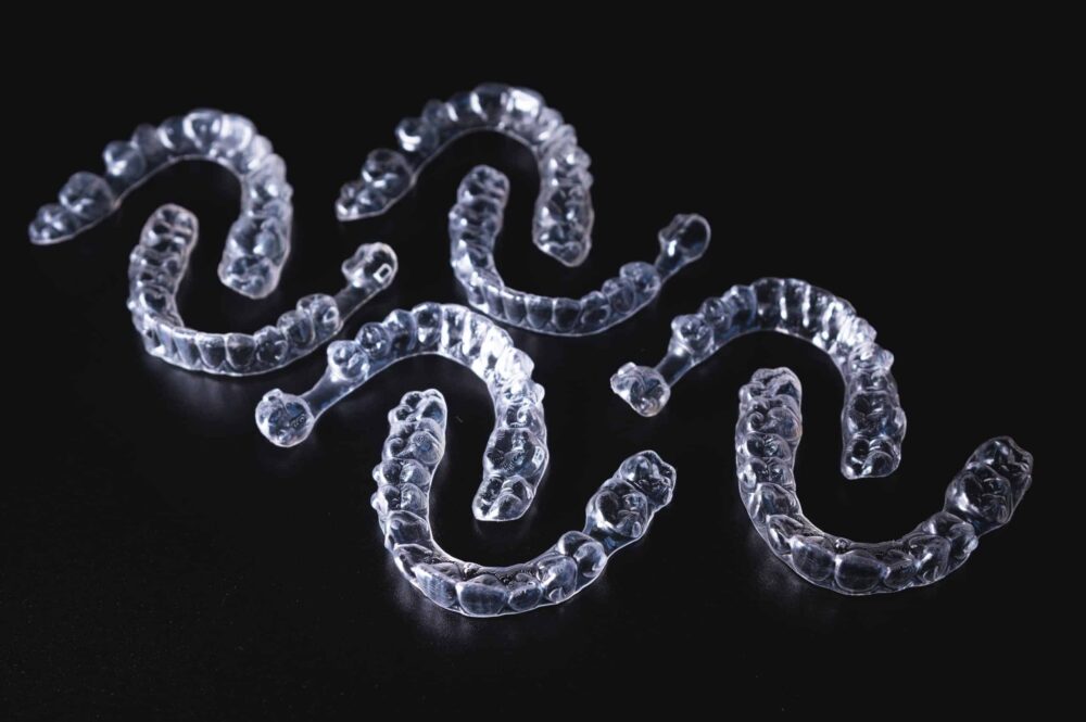 braces vs aligners